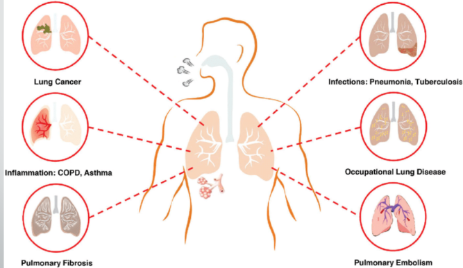 Keep Your Lungs Healthy